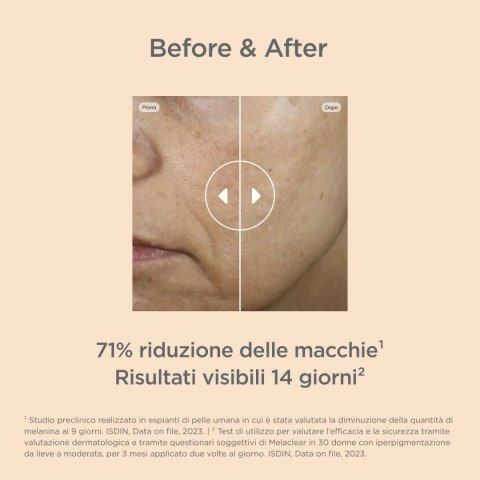 Serum przeciw Przebarwieniom Isdin Isdinceutics Melaclear Advanced 30 ml