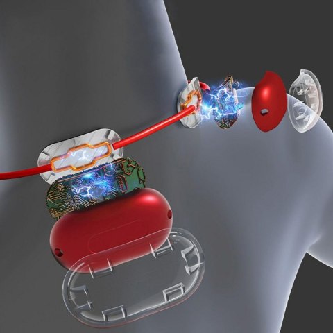 Elektrostymulator Media Tech MT6534