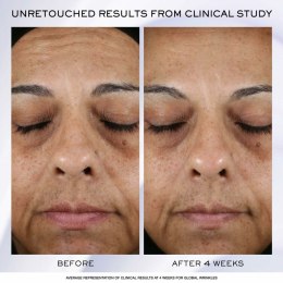 Krem na Dzień Lancôme Rénérgie Lift Ultra 50 ml