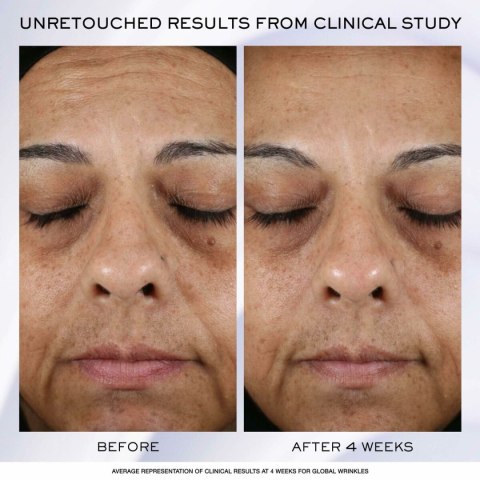 Krem na Dzień Lancôme Rénérgie Lift Ultra 50 ml