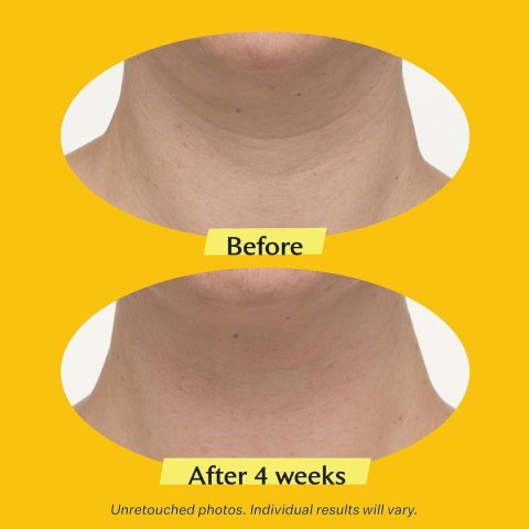 Krem do Twarzy StriVectin Tl Advanced Tightening 50 ml
